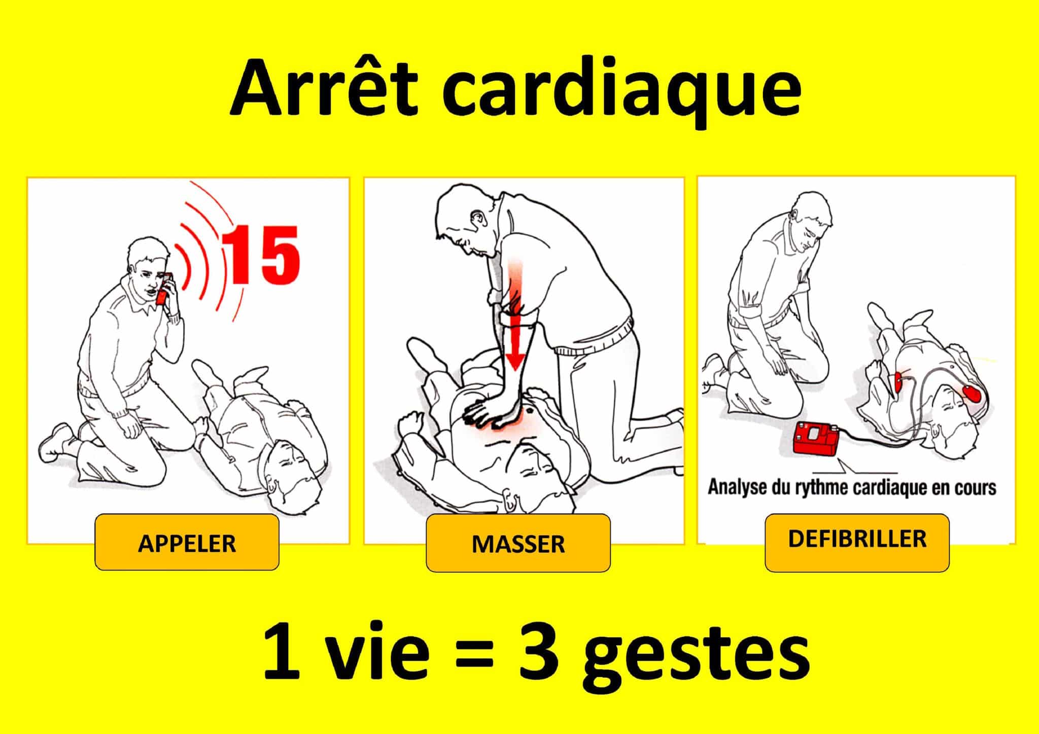 Prise En Charge De L arr t Cardiaque Premi re Session De L ann e 205 