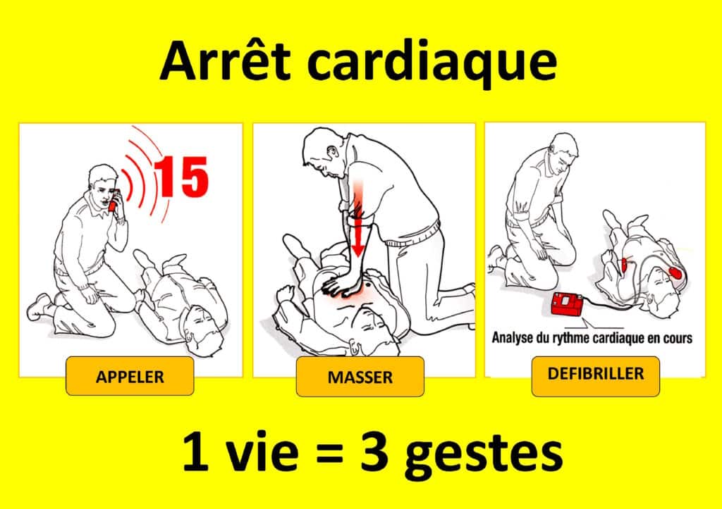 Arrêt cardiaque : apprenez à sauver 1 vie en 1 heure – Club Cœur et ...